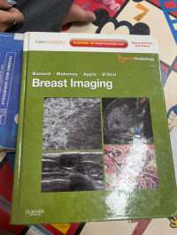 Image of Breast Imaging
